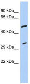 Tropomyosin 3 antibody, TA344003, Origene, Western Blot image 