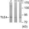 TLE Family Member 4, Transcriptional Corepressor antibody, EKC1775, Boster Biological Technology, Western Blot image 