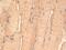 PTGES3L-AARSD1 Readthrough antibody, NBP2-12887, Novus Biologicals, Immunohistochemistry paraffin image 