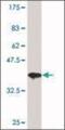 Histone Deacetylase 3 antibody, NB500-126, Novus Biologicals, Western Blot image 