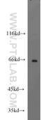 Suppression Of Tumorigenicity 7 Like antibody, 17567-1-AP, Proteintech Group, Western Blot image 