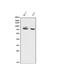 Forkhead Box P1 antibody, A00723, Boster Biological Technology, Western Blot image 