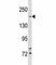 TSC Complex Subunit 2 antibody, F47584-0.4ML, NSJ Bioreagents, Western Blot image 