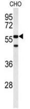 Actin Related Protein 5 antibody, GTX80453, GeneTex, Western Blot image 
