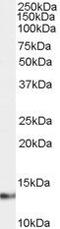 S100 Calcium Binding Protein A4 antibody, PA5-18601, Invitrogen Antibodies, Western Blot image 