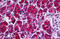 Pancreatic secretory trypsin inhibitor antibody, MBS245513, MyBioSource, Immunohistochemistry paraffin image 