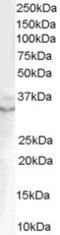 Growth Differentiation Factor 15 antibody, STJ70767, St John