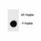 Inhibitor Of Nuclear Factor Kappa B Kinase Subunit Beta antibody, F48704-0.4ML, NSJ Bioreagents, Dot Blot image 