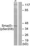 SMAD Family Member 3 antibody, PA5-38521, Invitrogen Antibodies, Western Blot image 