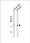 Natriuretic Peptide A antibody, PA5-72527, Invitrogen Antibodies, Western Blot image 