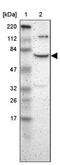 Zinc Finger With KRAB And SCAN Domains 8 antibody, PA5-51942, Invitrogen Antibodies, Western Blot image 