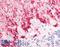 Solute Carrier Family 1 Member 3 antibody, LS-A9447, Lifespan Biosciences, Immunohistochemistry paraffin image 