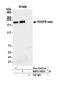 Platelet Derived Growth Factor Receptor Beta antibody, NBP2-78835, Novus Biologicals, Immunoprecipitation image 