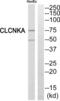 Chloride Voltage-Gated Channel Ka antibody, abx014353, Abbexa, Western Blot image 