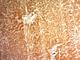 Glypican 3 antibody, V2536IHC-7ML, NSJ Bioreagents, Immunohistochemistry paraffin image 