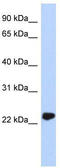 Ubiquitin C-Terminal Hydrolase L3 antibody, TA344239, Origene, Western Blot image 