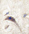 Dishevelled Associated Activator Of Morphogenesis 1 antibody, 61-449, ProSci, Immunohistochemistry paraffin image 