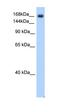 Sodium Voltage-Gated Channel Alpha Subunit 5 antibody, orb329836, Biorbyt, Western Blot image 