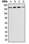 Phosphatidylinositol-4-Phosphate 3-Kinase Catalytic Subunit Type 2 Gamma antibody, orb214395, Biorbyt, Western Blot image 