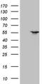 LXR antibody, NBP2-46220, Novus Biologicals, Western Blot image 