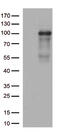 ADAM Metallopeptidase Domain 28 antibody, M06873, Boster Biological Technology, Western Blot image 