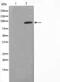 Nuclear Receptor Subfamily 3 Group C Member 1 antibody, abx011850, Abbexa, Western Blot image 