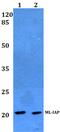 Baculoviral IAP Repeat Containing 7 antibody, PA5-75440, Invitrogen Antibodies, Western Blot image 