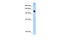 SWI/SNF Related, Matrix Associated, Actin Dependent Regulator Of Chromatin, Subfamily A, Member 5 antibody, 27-270, ProSci, Western Blot image 