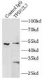 TPD52 Like 2 antibody, FNab08883, FineTest, Immunoprecipitation image 