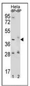 Hyaluronidase 2 antibody, AP52133PU-N, Origene, Western Blot image 