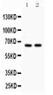 M-phase inducer phosphatase 2 antibody, PB9488, Boster Biological Technology, Western Blot image 