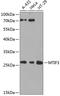 Mitochondrial Translational Initiation Factor 3 antibody, GTX65982, GeneTex, Western Blot image 