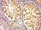 Ring Finger Protein 133 antibody, orb1218, Biorbyt, Immunohistochemistry paraffin image 