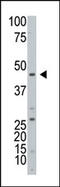 ADP-Ribosyltransferase 3 antibody, AP12147PU-N, Origene, Western Blot image 