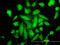 Protein Kinase C Alpha antibody, LS-C133397, Lifespan Biosciences, Immunofluorescence image 