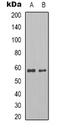 Pyruvate Kinase M1/2 antibody, orb339210, Biorbyt, Western Blot image 