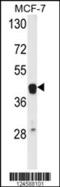 ETS Proto-Oncogene 2, Transcription Factor antibody, 64-143, ProSci, Western Blot image 