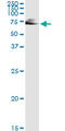 Inosine Monophosphate Dehydrogenase 2 antibody, LS-C197533, Lifespan Biosciences, Immunoprecipitation image 