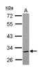 Tripartite Motif Containing 4 antibody, NBP2-20716, Novus Biologicals, Western Blot image 