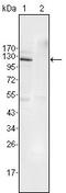 EPH Receptor B4 antibody, GTX83017, GeneTex, Western Blot image 