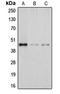 Deoxyhypusine Synthase antibody, LS-C352107, Lifespan Biosciences, Western Blot image 