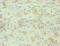 TOR antibody, CSB-PA020071LA01HU, Cusabio, Immunohistochemistry paraffin image 