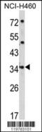 Cerberus 1, DAN Family BMP Antagonist antibody, 62-558, ProSci, Western Blot image 