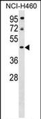 Putative protein PLEKHA9 antibody, PA5-72046, Invitrogen Antibodies, Western Blot image 