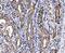 Distal-Less Homeobox 2 antibody, A03617-2, Boster Biological Technology, Immunohistochemistry paraffin image 