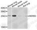 Methionine Sulfoxide Reductase B3 antibody, A8005, ABclonal Technology, Western Blot image 