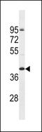 Olfactory Receptor Family 2 Subfamily T Member 5 antibody, LS-C158468, Lifespan Biosciences, Western Blot image 