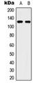 Unc-51 Like Autophagy Activating Kinase 2 antibody, LS-B13288, Lifespan Biosciences, Western Blot image 