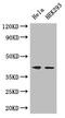 Actin Gamma 1 antibody, LS-C500028, Lifespan Biosciences, Western Blot image 