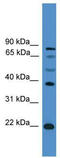 Achaete-Scute Family BHLH Transcription Factor 2 antibody, TA343510, Origene, Western Blot image 